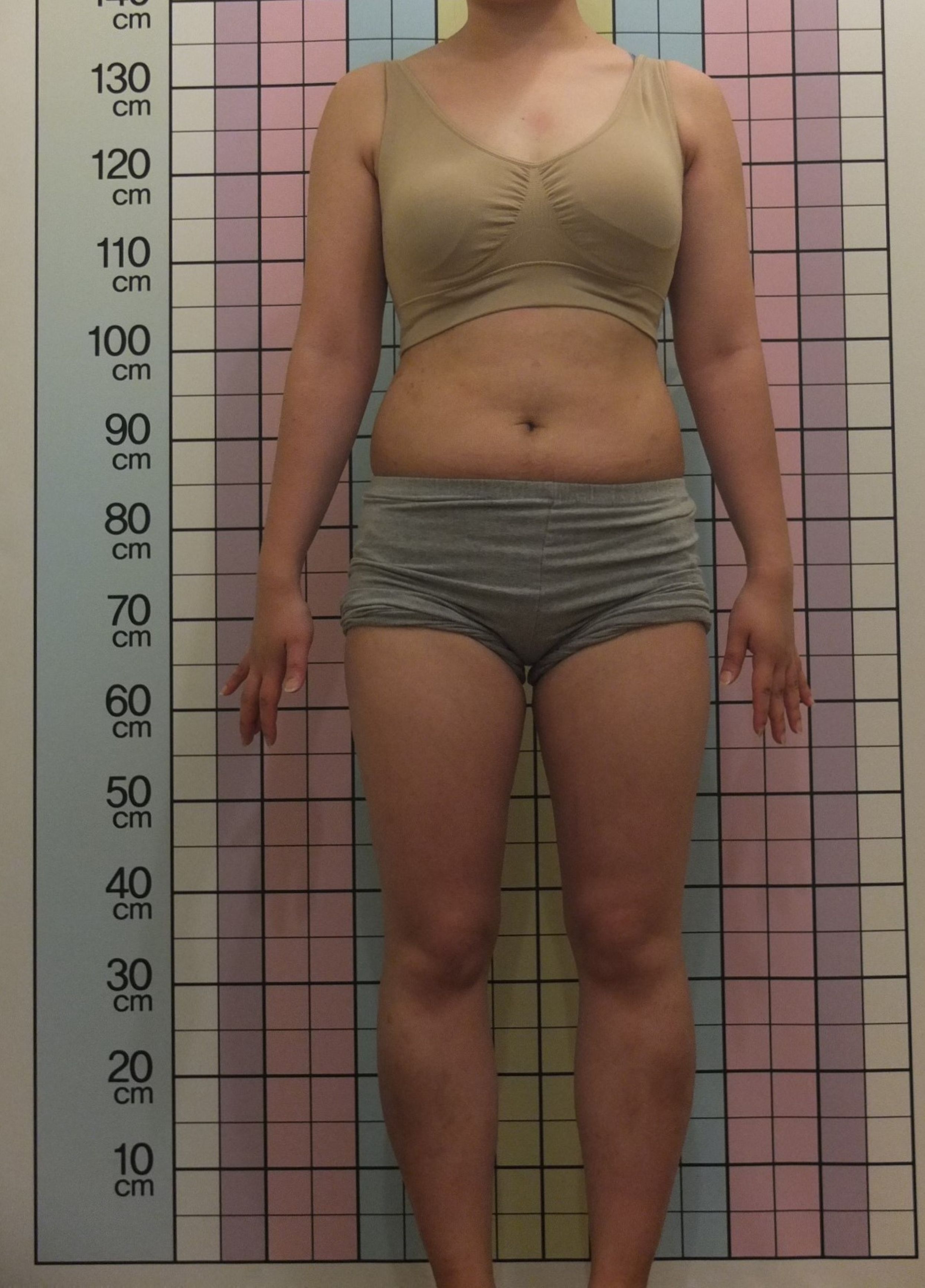 20대 -5.8kg