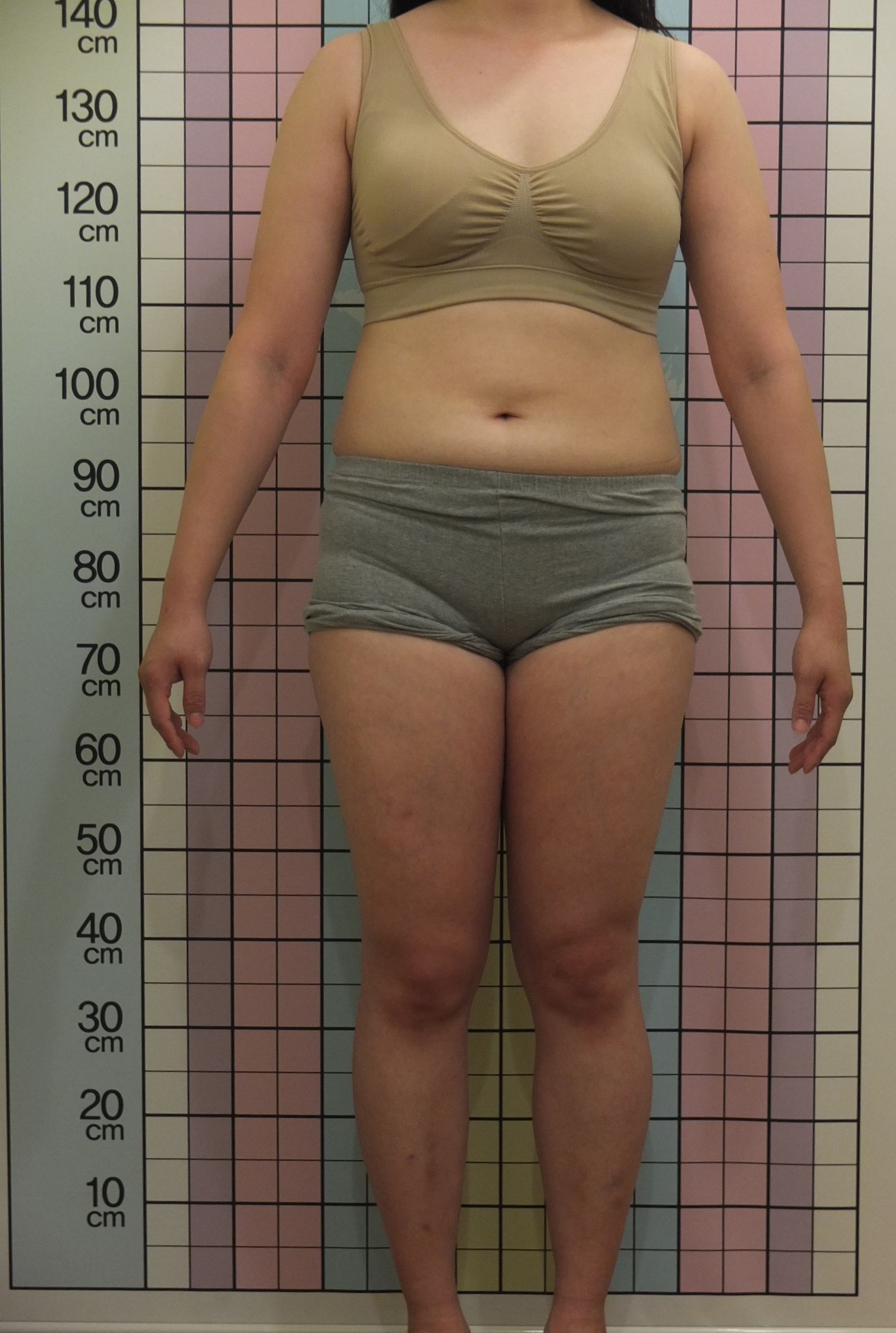20대 여성 -7.9kg