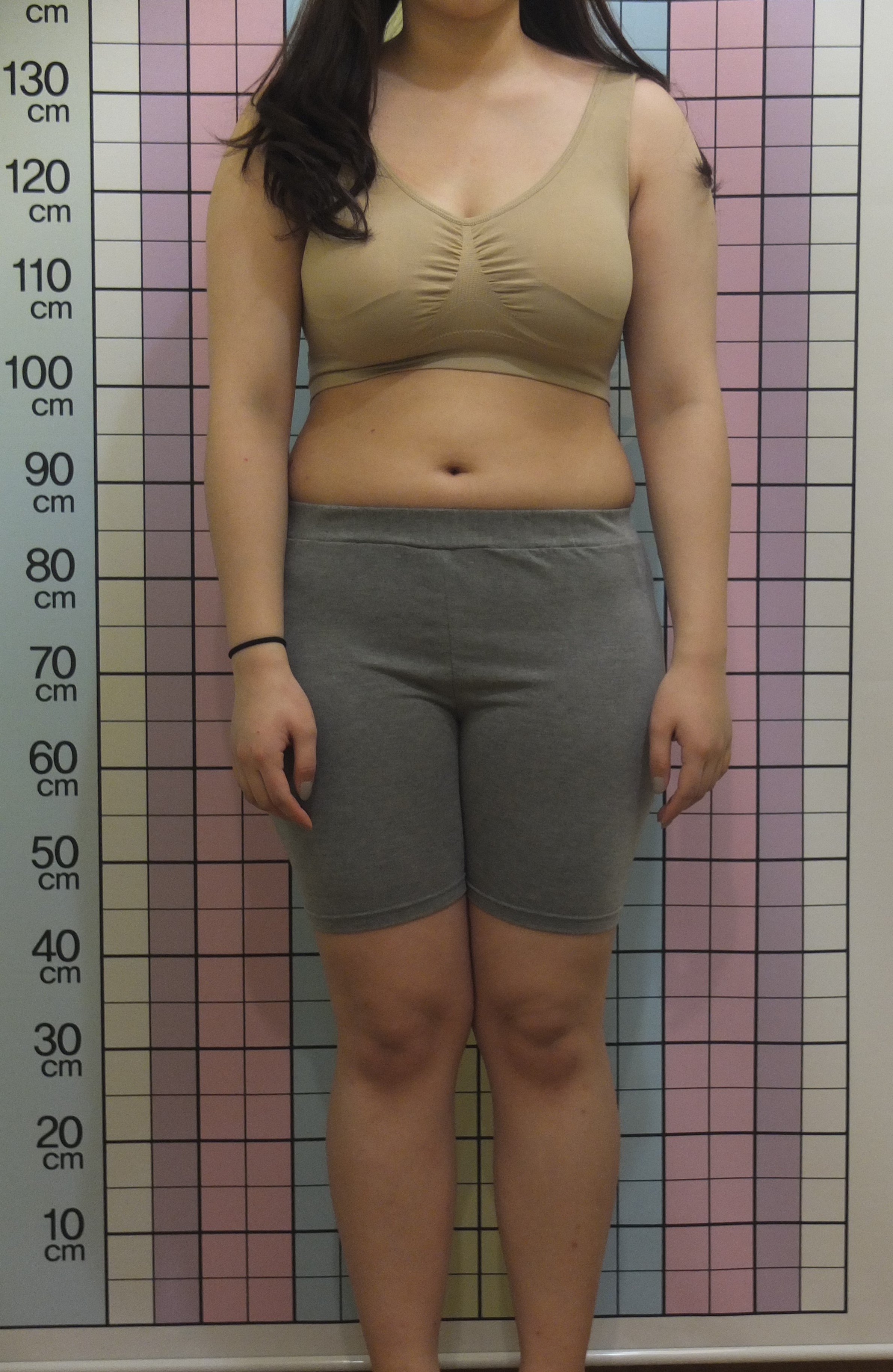 20대 여성 -11.9kg