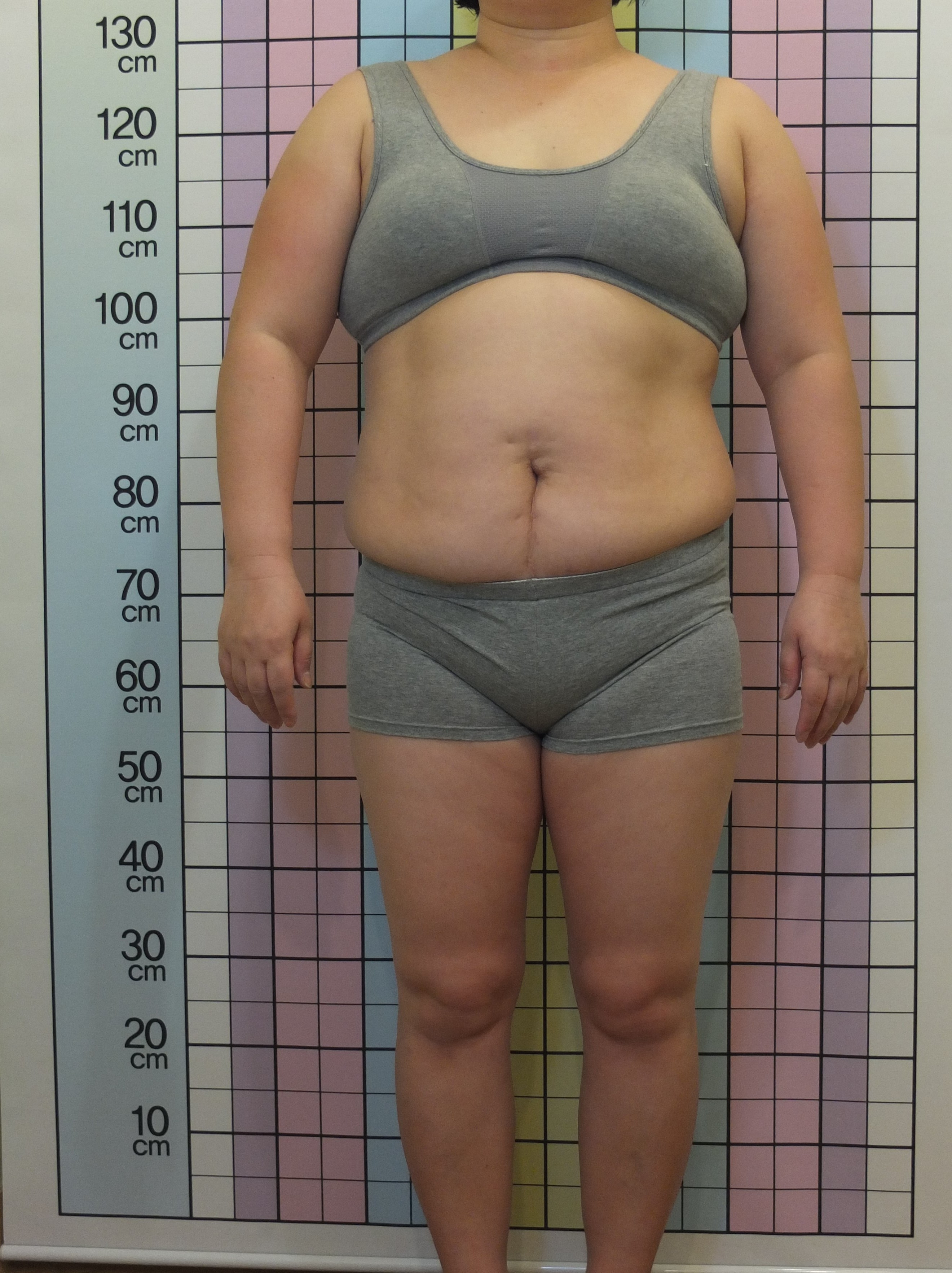 40대 여성 -10.7kg