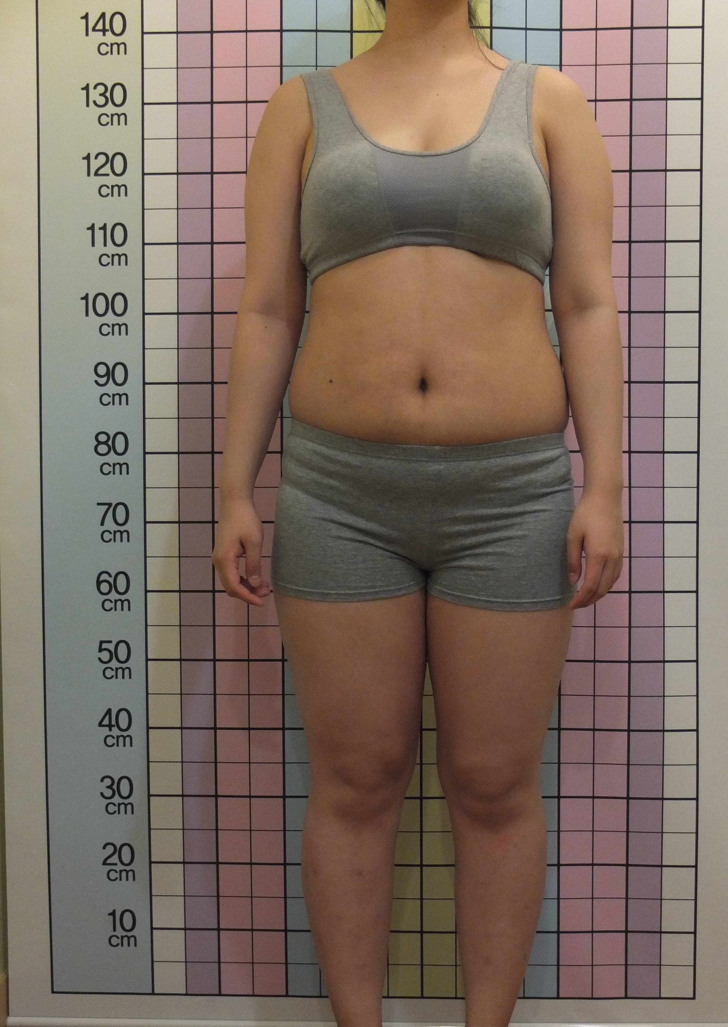 20대 여성 -14.5kg